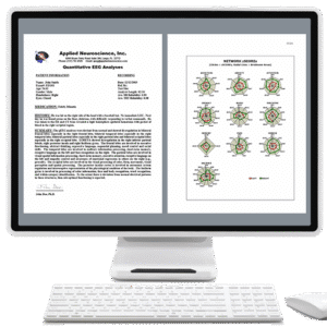 Automatic Clinical Reports