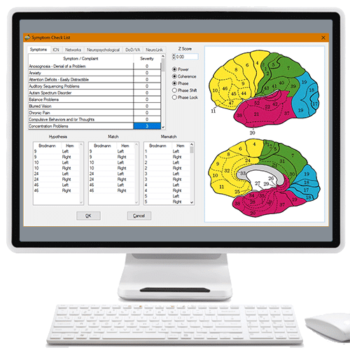 3-D sLORETA Z Score Neurofeedback