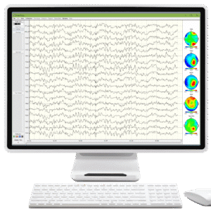 NeuroGuide Acquisition