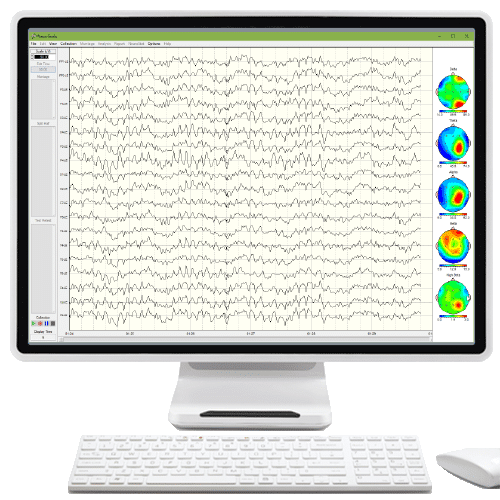 NeuroGuide Acquisition