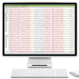 NeuroGuide Viewer