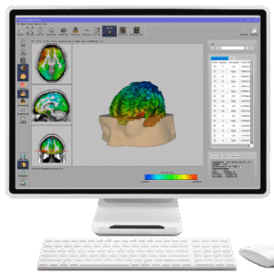 NeuroNavigator