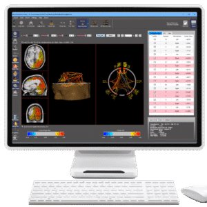 NeuroNavigator’s swLORETA Phase Reset Normative Database