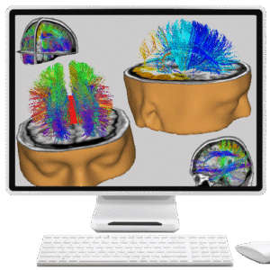 NeuroNavigator’s Diffusion Tensor Imaging Overlay