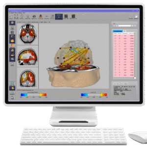NeuroNavigator’s swLORETA Functional Connectivity Normative Database