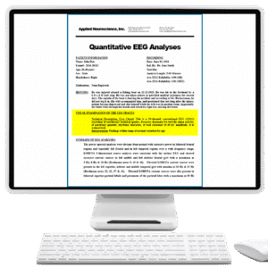 QEEG Report with Visual Review of EEG Traces