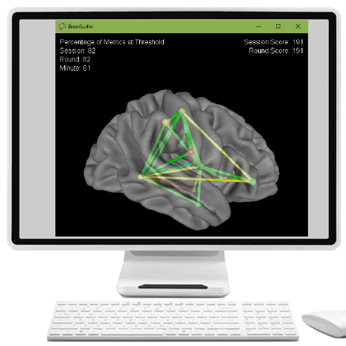 BrainSurfer