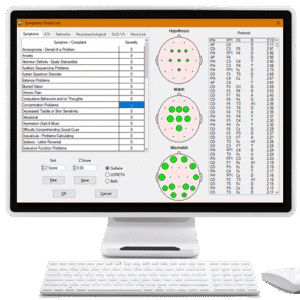 Surface 1 to 19 Channel Z Score Neurofeedback