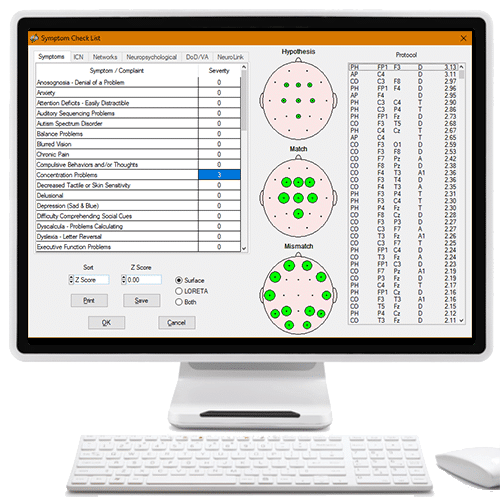 Surface 1 to 19 Channel Z Score Neurofeedback